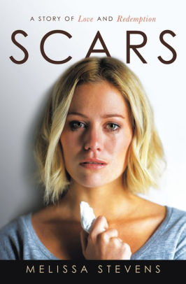 Scars