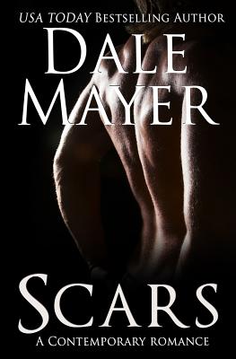 Scars