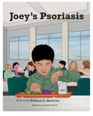 Joey's Psoriasis